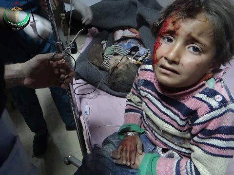 Syria - Children - Child bleeding face - WODHR - 30-3-013