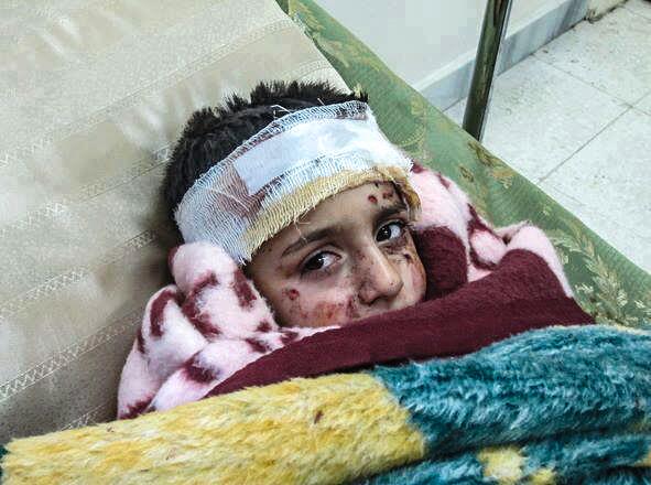 Syria - Children - Boy injured and traumatized