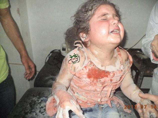Syria - Injured - Child Bloodied and Crying